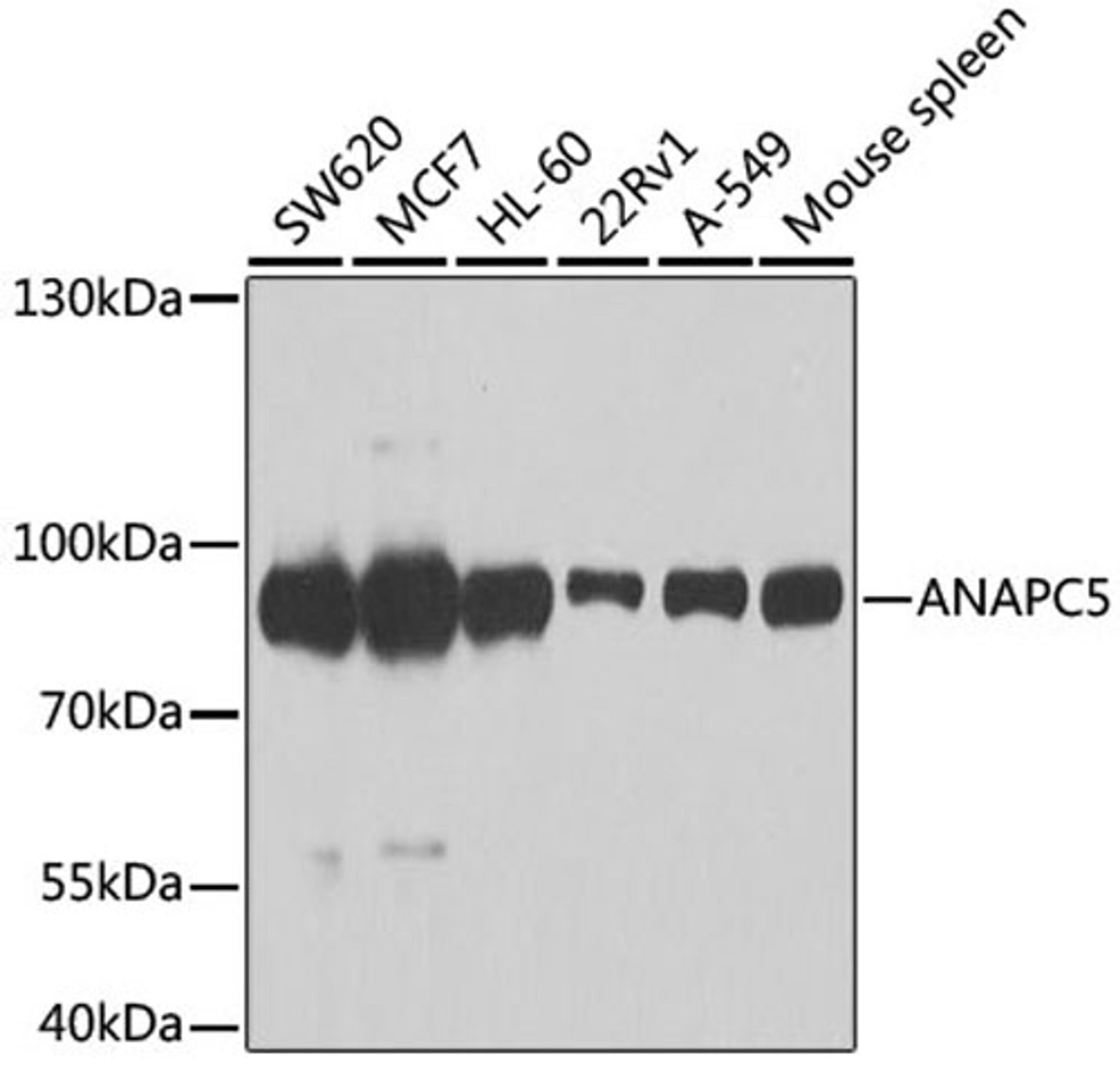 Western blot - ANAPC5 antibody (A7109)