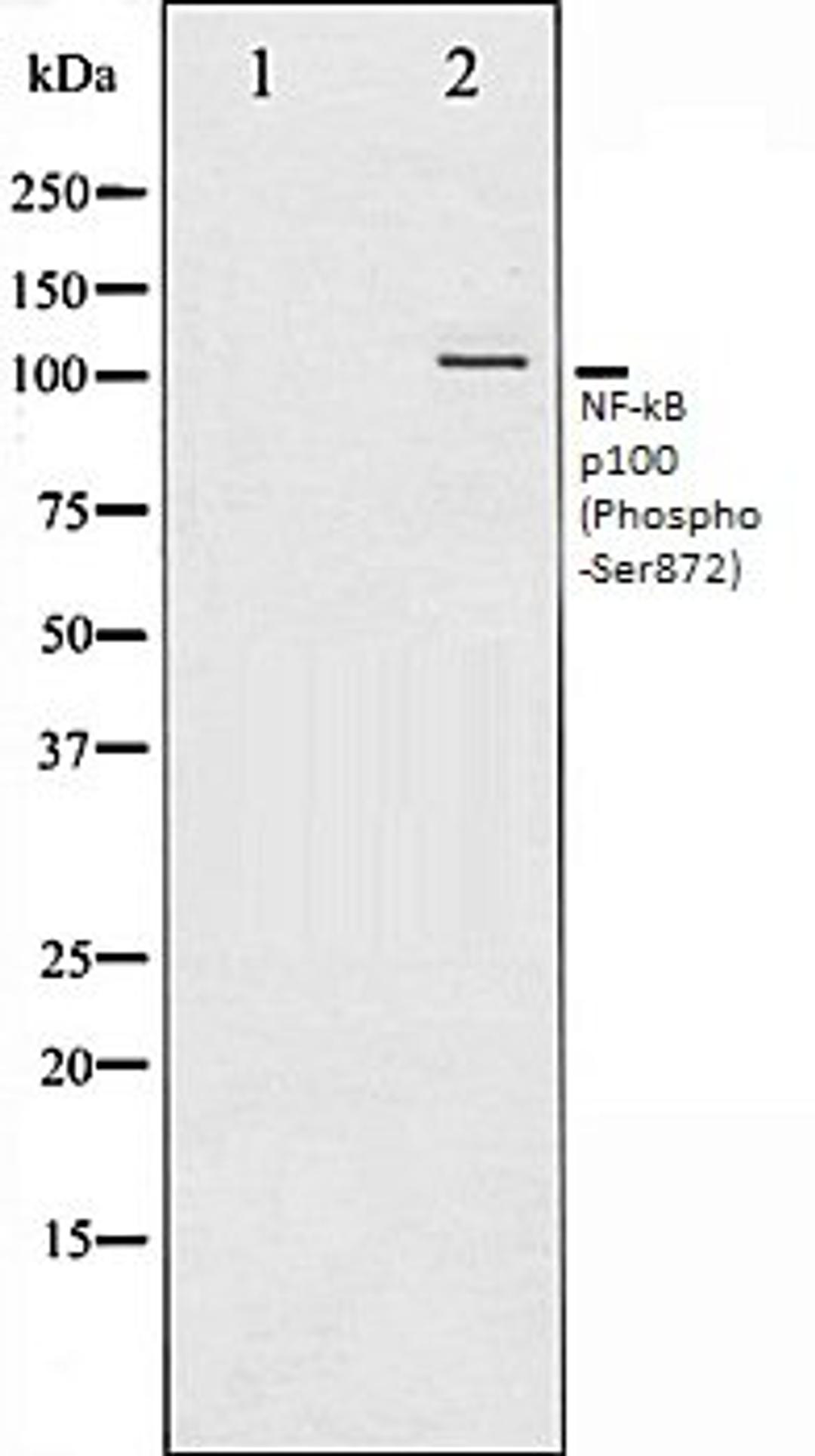 Western blot analysis of RAW264.7 whole cell lysates using NF-?B p100 (Phospho-Ser872) antibody, The lane on the left is treated with the antigen-specific peptide.