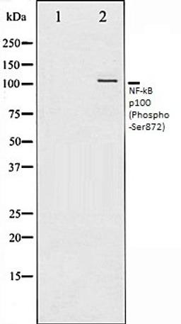 Western blot analysis of RAW264.7 whole cell lysates using NF-?B p100 (Phospho-Ser872) antibody, The lane on the left is treated with the antigen-specific peptide.