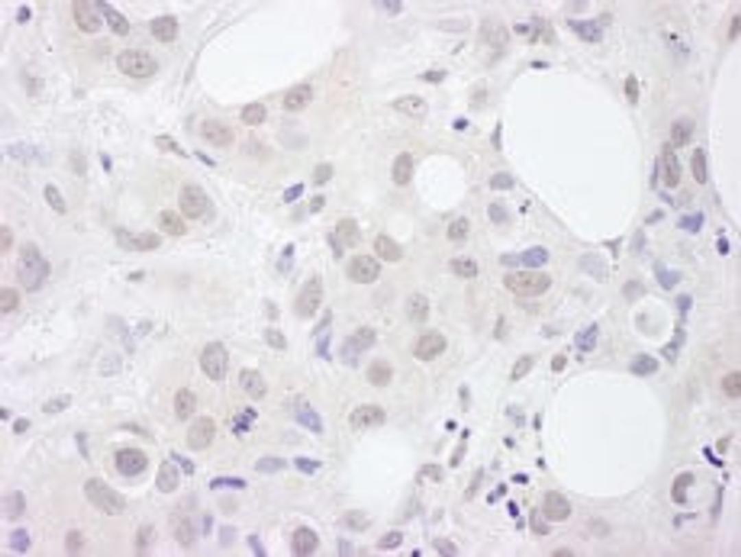 Detection of human U2AF65 by immunohistochemistry.