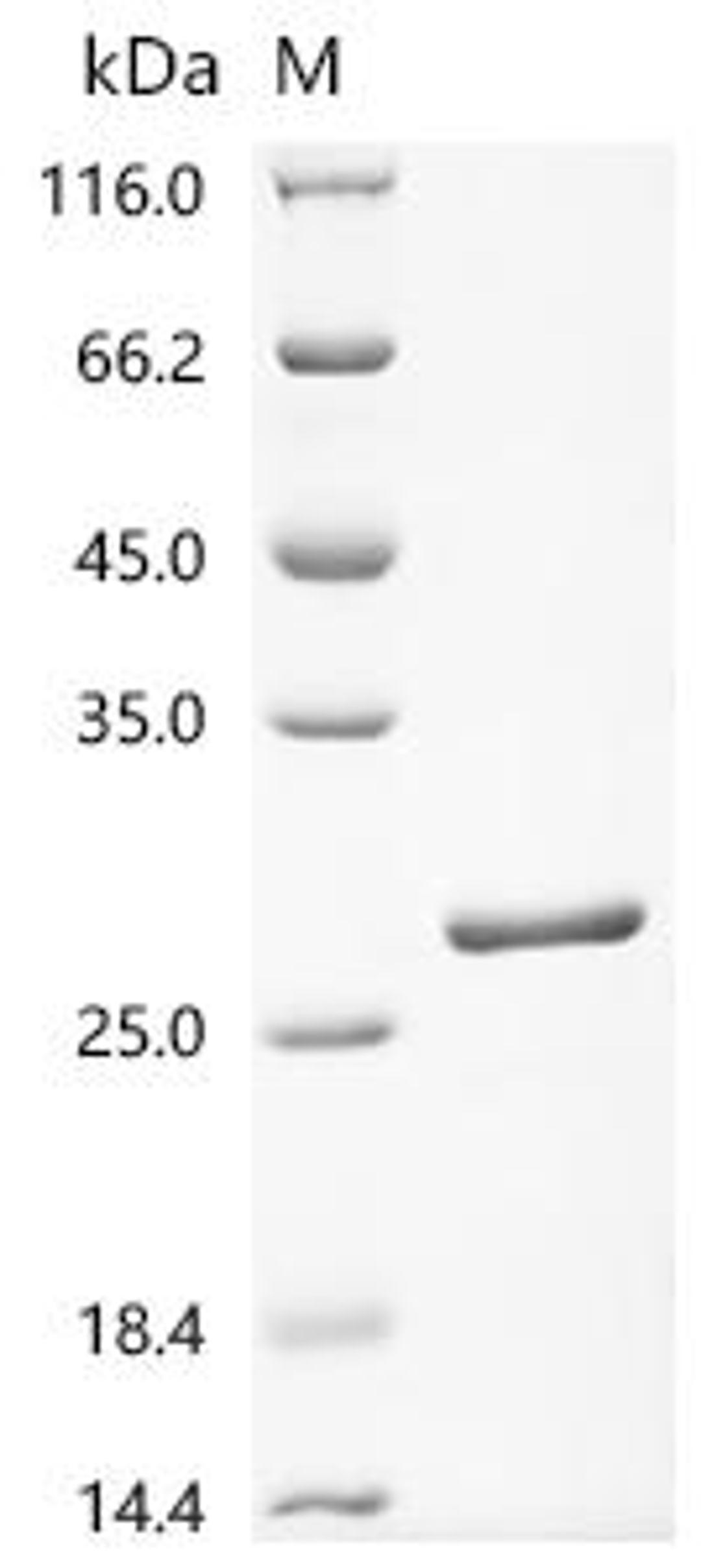 (Tris-Glycine gel) Discontinuous SDS-PAGE (reduced) with 5% enrichment gel and 15% separation gel.