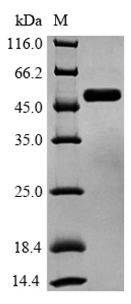 (Tris-Glycine gel) Discontinuous SDS-PAGE (reduced) with 5% enrichment gel and 15% separation gel.