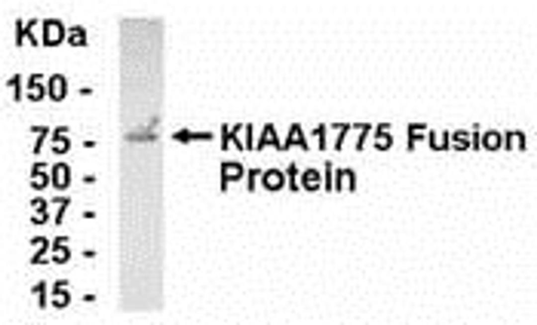 E coli-derived fusion protein as test antigen. Affinity-purified IgY dilution: 1:2000, Goat anti-IgY-HRP dilution: 1:1000. Colorimetric method for signal development.