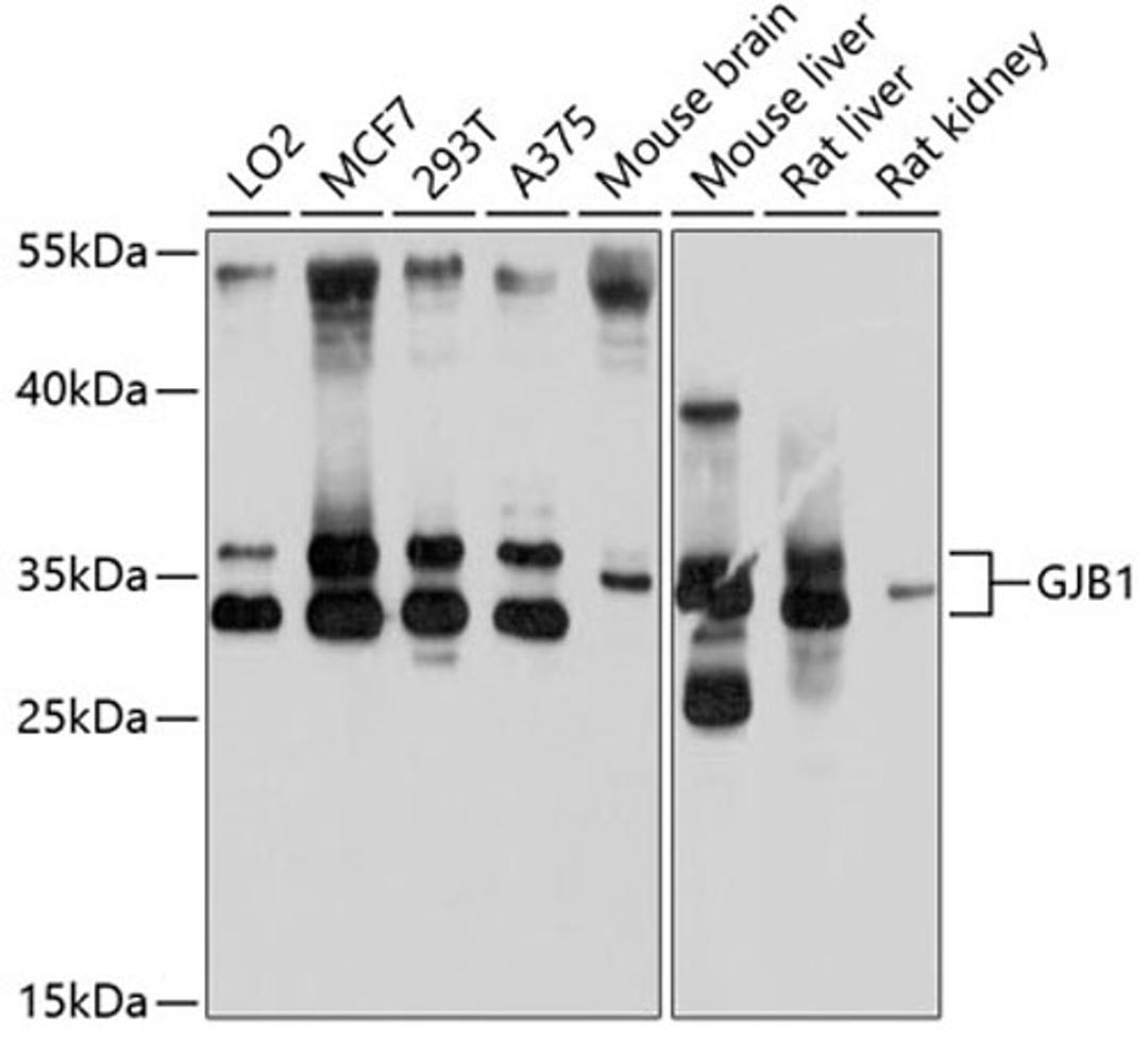 Western blot - GJB1 antibody (A10112)