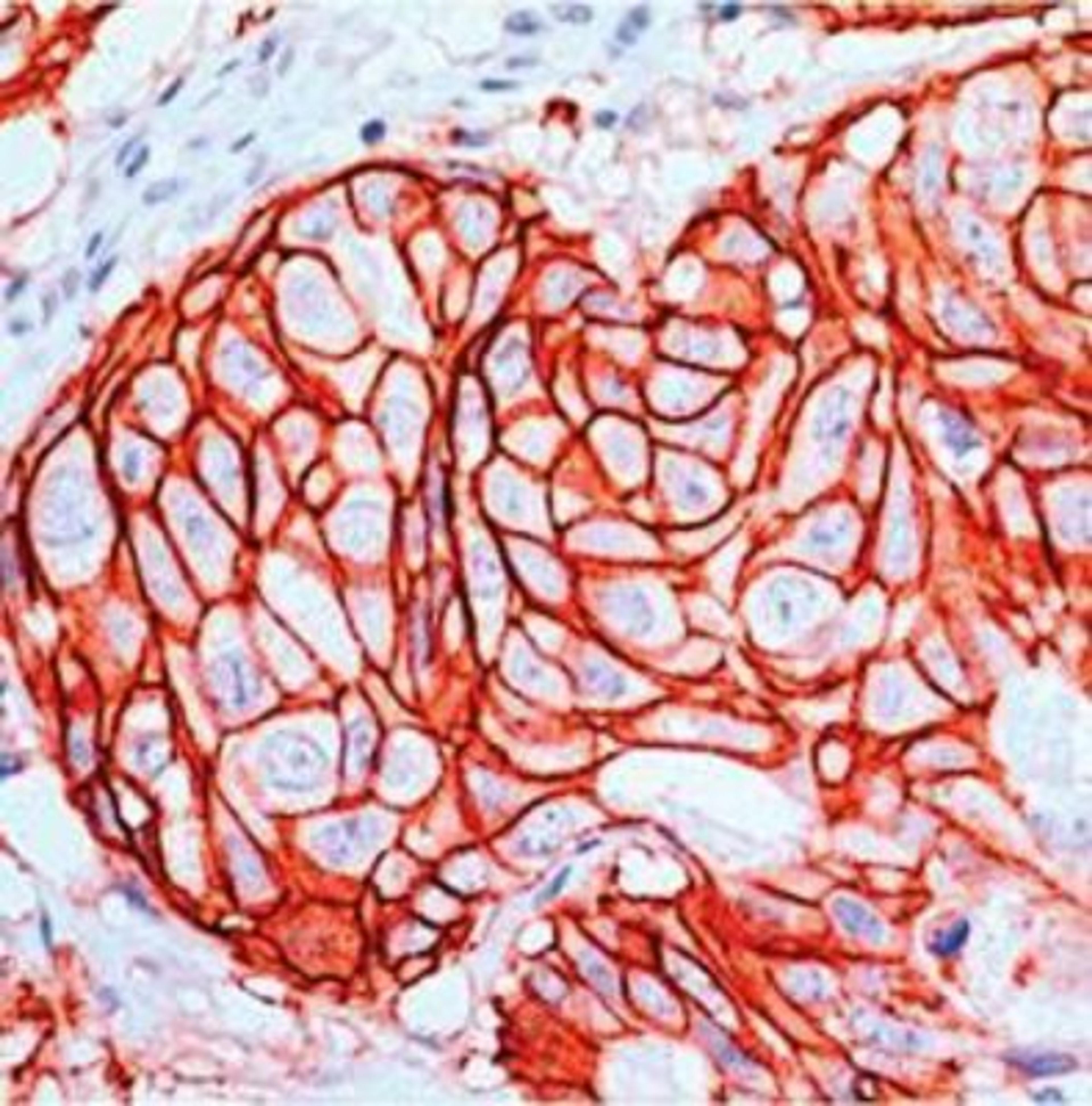 Immunohistochemistry-Paraffin: ErbB2/HER2 Antibody (SP3) [NBP1-49793] - c-erbB-2/HER-2