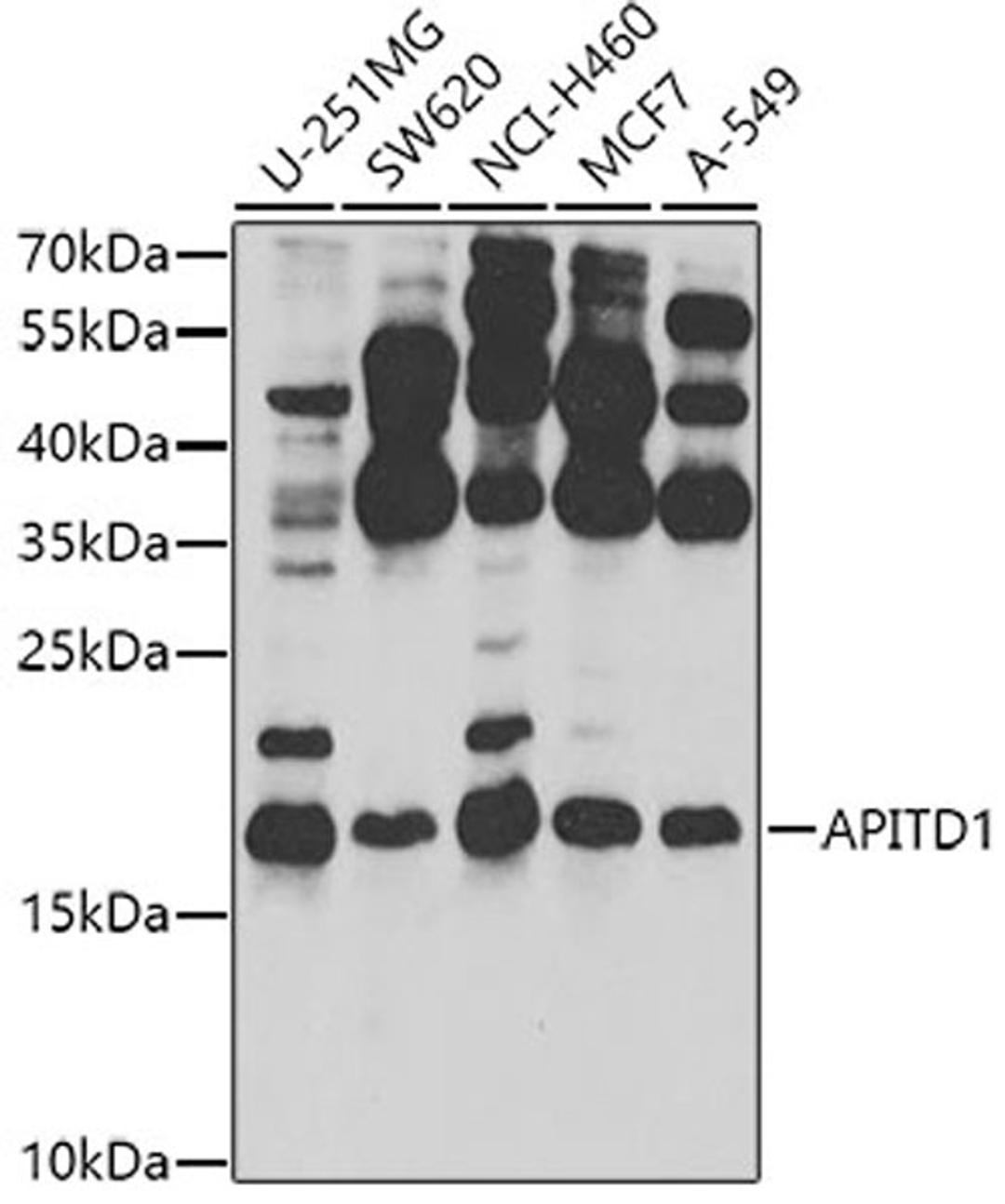 Western blot - APITD1 antibody (A8293)