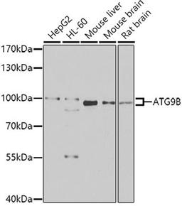 Western blot - ATG9B antibody (A7406)