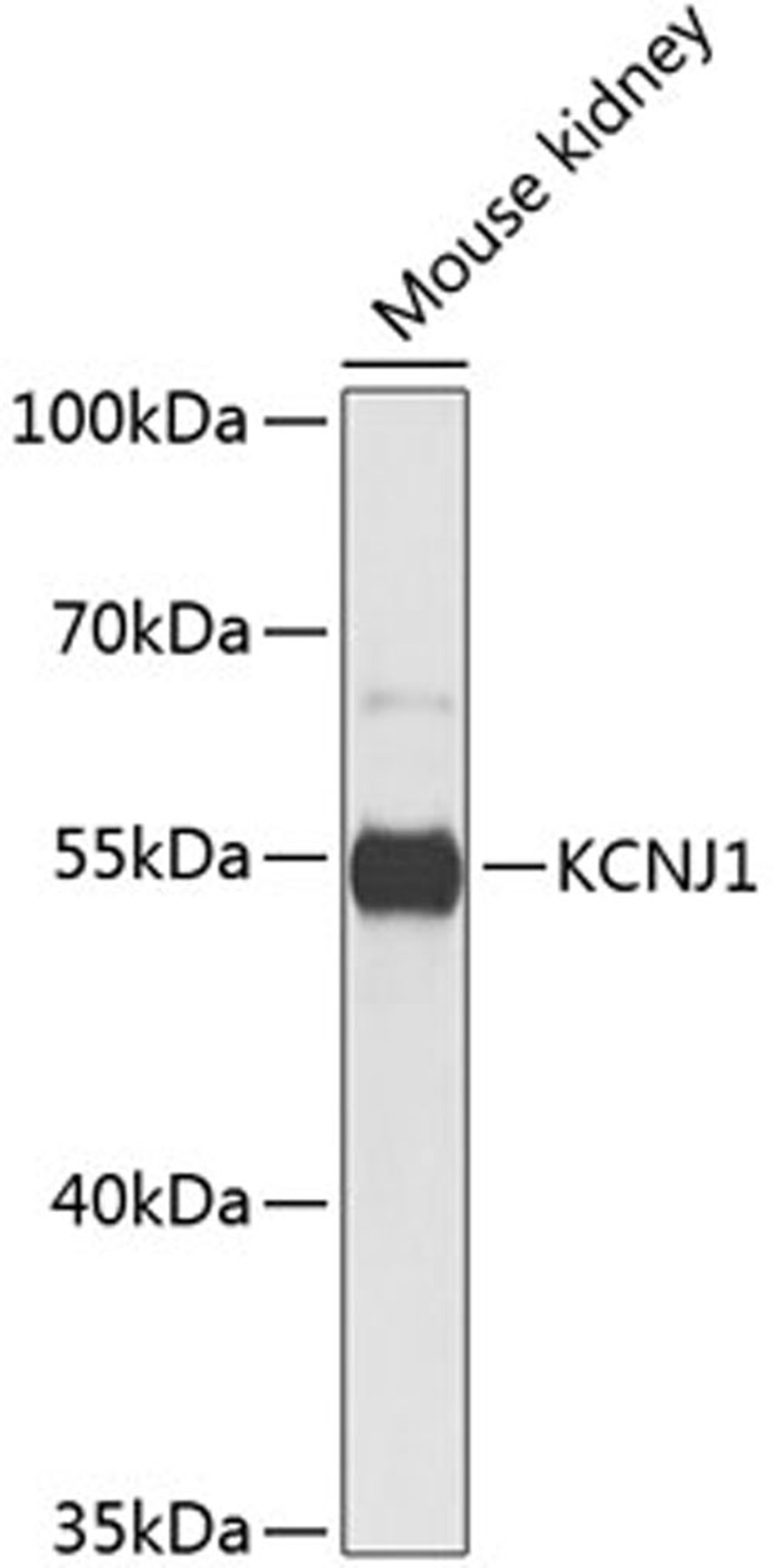 Western blot - KCNJ1 antibody (A8554)