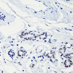 Immunohistochemistry  - H2AK5ac antibody (A15620)