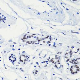 Immunohistochemistry - H2AK5ac antibody (A15620)
