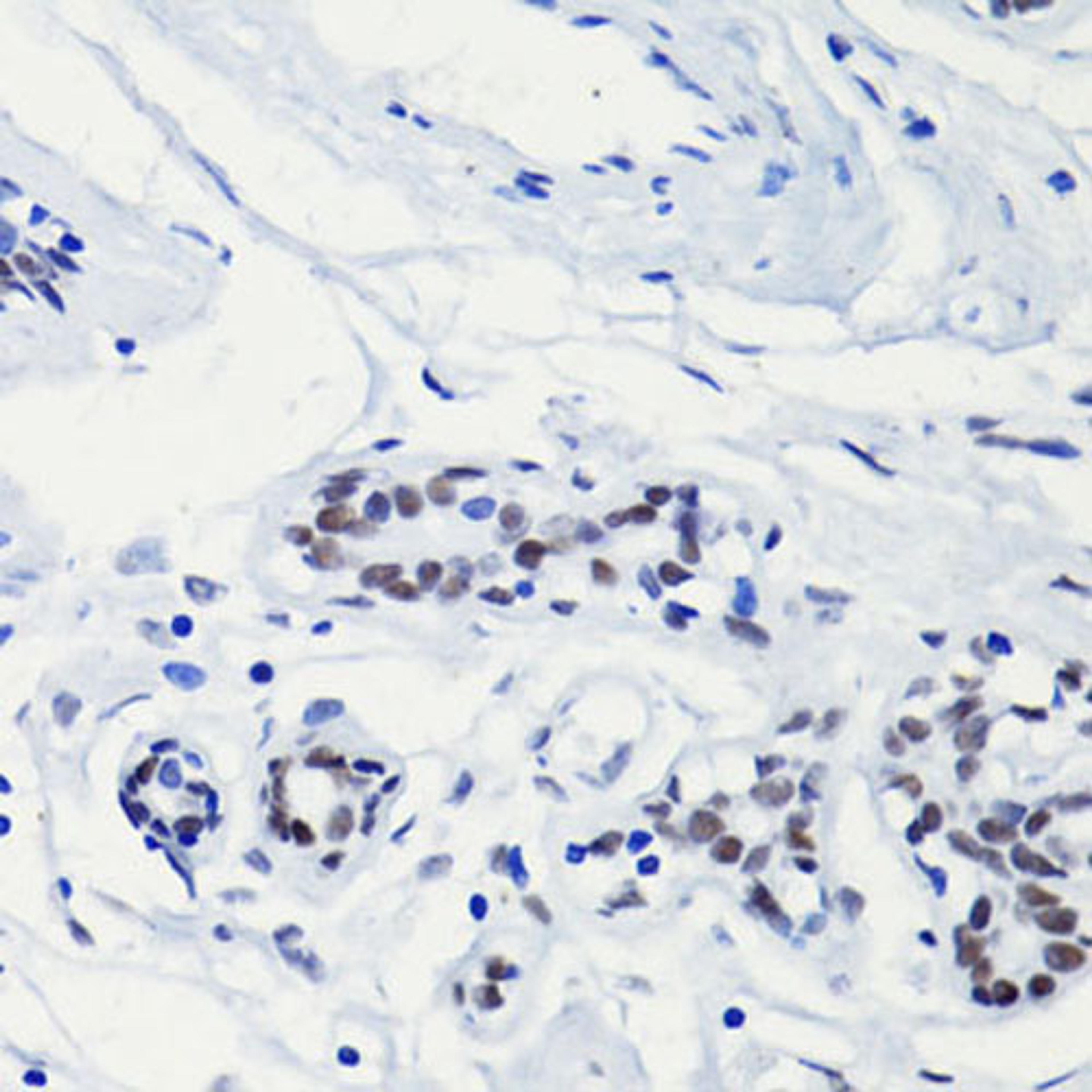 Immunohistochemistry - H2AK5ac antibody (A15620)
