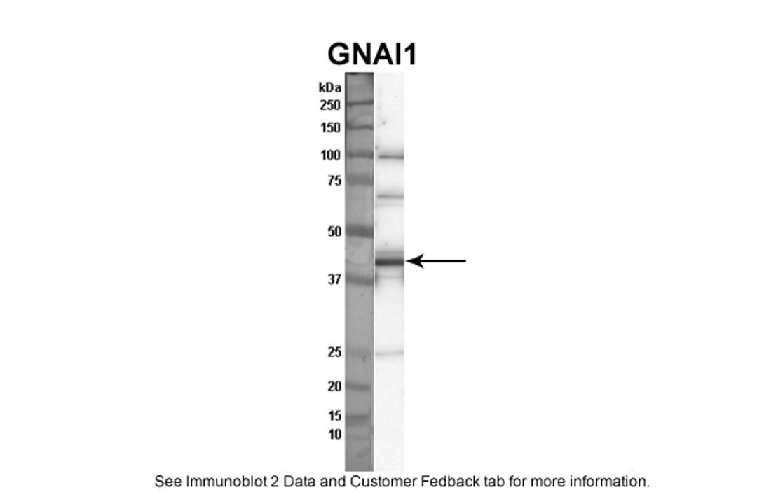 Antibody used in WB on human thryoid at 1:1000.