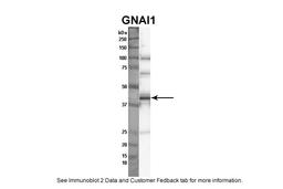 Antibody used in WB on human thryoid at 1:1000.