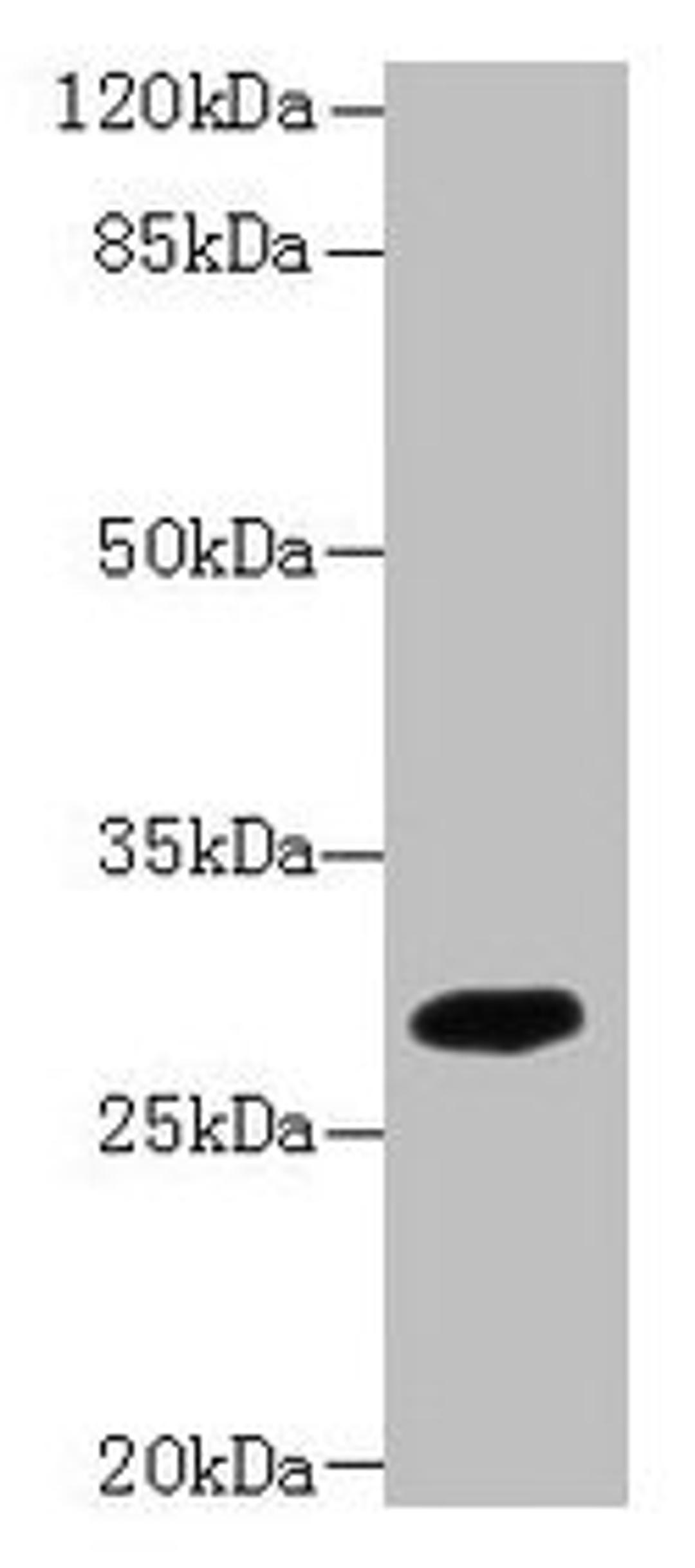 Western blot. All lanes: PIP4P2 antibody at 5µg/ml + Mouse liver tissue. Secondary. Goat polyclonal to rabbit IgG at 1/10000 dilution. Predicted band size: 29 kDa. Observed band size: 29 kDa