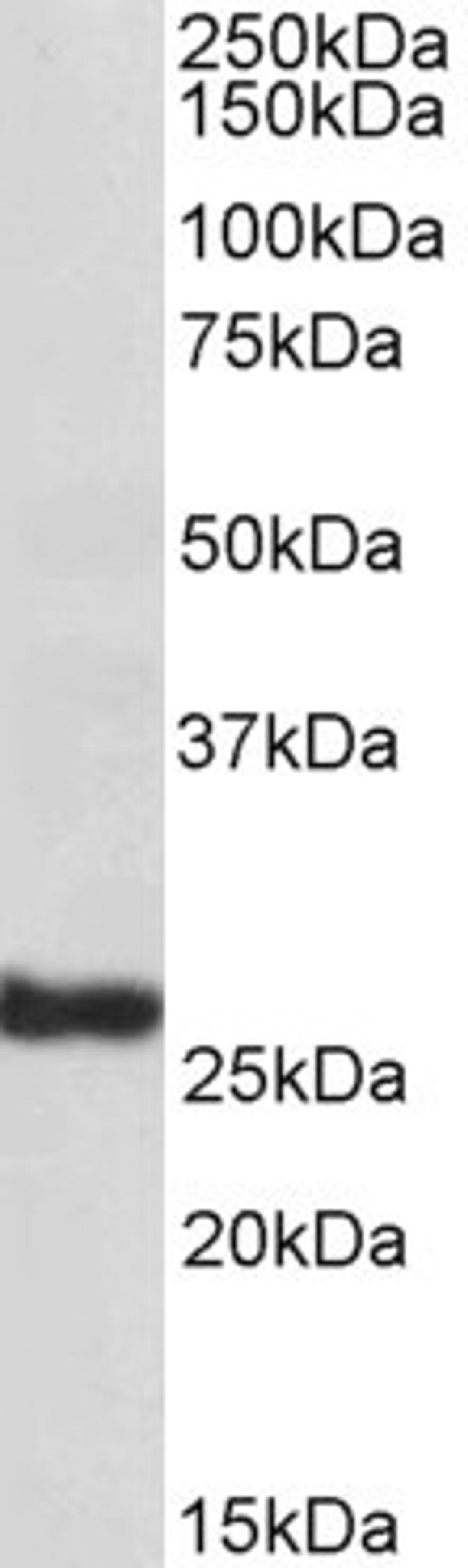 46-204 (1ug/ml) staining of Human Skin lysate (35ug protein in RIPA buffer). Primary incubation was 1 hour. Detected by chemiluminescence.