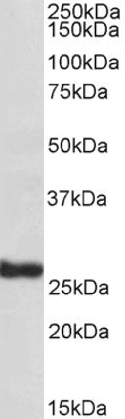 46-204 (1ug/ml) staining of Human Skin lysate (35ug protein in RIPA buffer). Primary incubation was 1 hour. Detected by chemiluminescence.