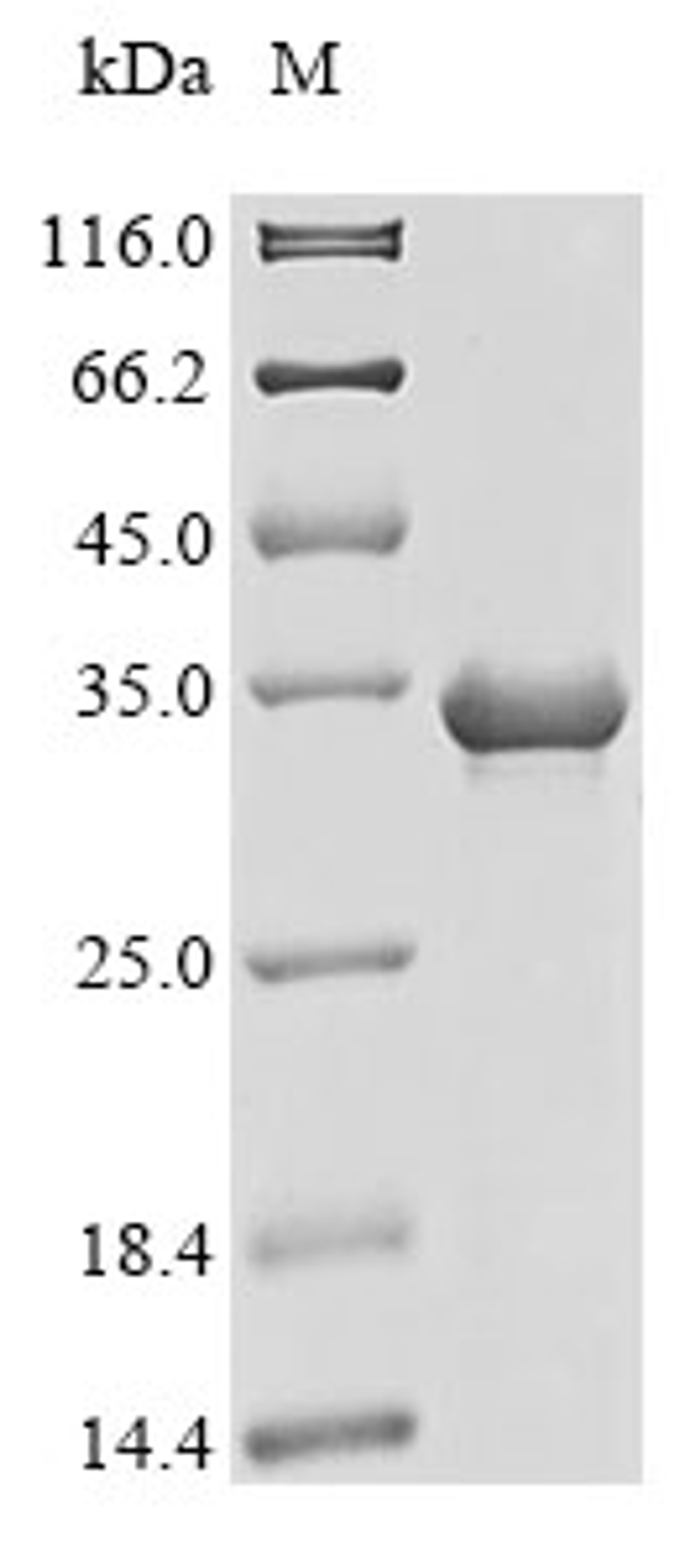 (Tris-Glycine gel) Discontinuous SDS-PAGE (reduced) with 5% enrichment gel and 15% separation gel.