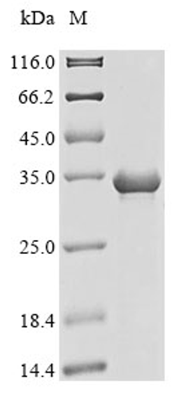 (Tris-Glycine gel) Discontinuous SDS-PAGE (reduced) with 5% enrichment gel and 15% separation gel.