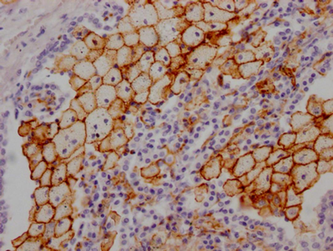 IHC image of CSB-RA268157A0HU diluted at 1:100 and staining in paraffin-embedded human lung tissue performed on a Leica BondTM system. After dewaxing and hydration, antigen retrieval was mediated by high pressure in a citrate buffer (pH 6.0). Section was blocked with 10% normal goat serum 30min at RT. Then primary antibody (1% BSA) was incubated at 4℃ overnight. The primary is detected by a Goat anti-rabbit IgG polymer labeled by HRP and visualized using 0.05% DAB.