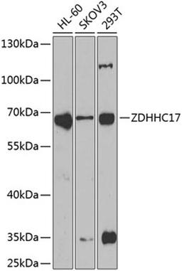 Western blot - ZDHHC17 antibody (A6793)