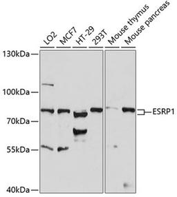 Western blot - ESRP1 antibody (A14626)