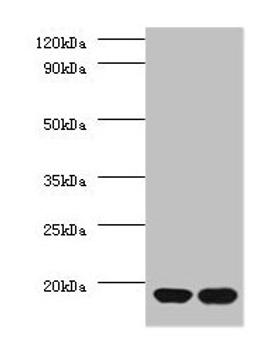 Western blot. All lanes: RPS13 antibody at 2µg/ml. Lane 1: EC109 whole cell lysate. Lane 2: 293T whole cell lysate. Secondary. Goat polyclonal to rabbit IgG at 1/15000 dilution. Predicted band size: 18 kDa. Observed band size: 18 kDa