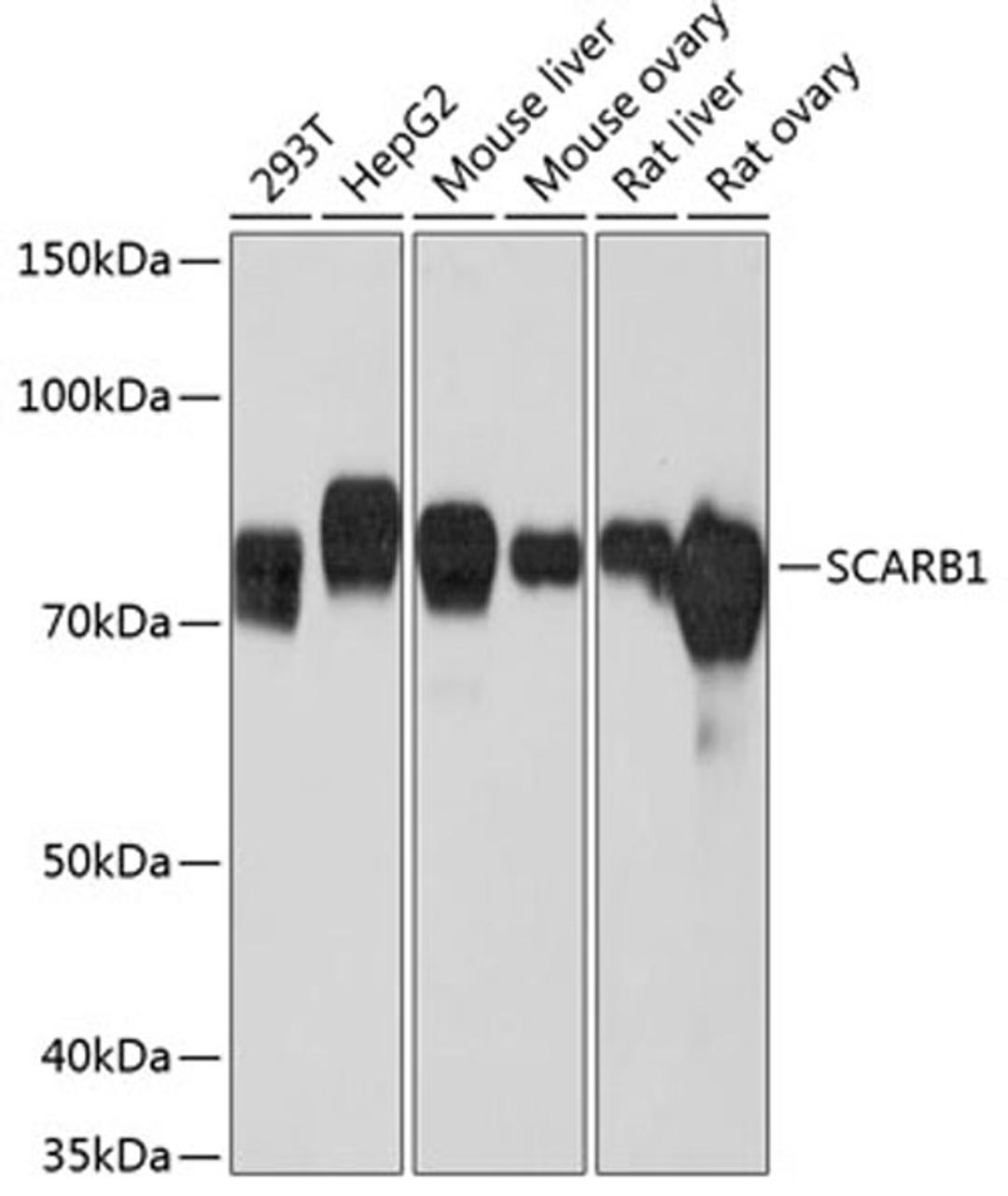 Western blot - SCARB1 Rabbit mAb (A0827)