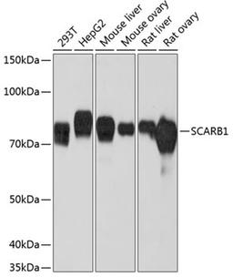 Western blot - SCARB1 Rabbit mAb (A0827)