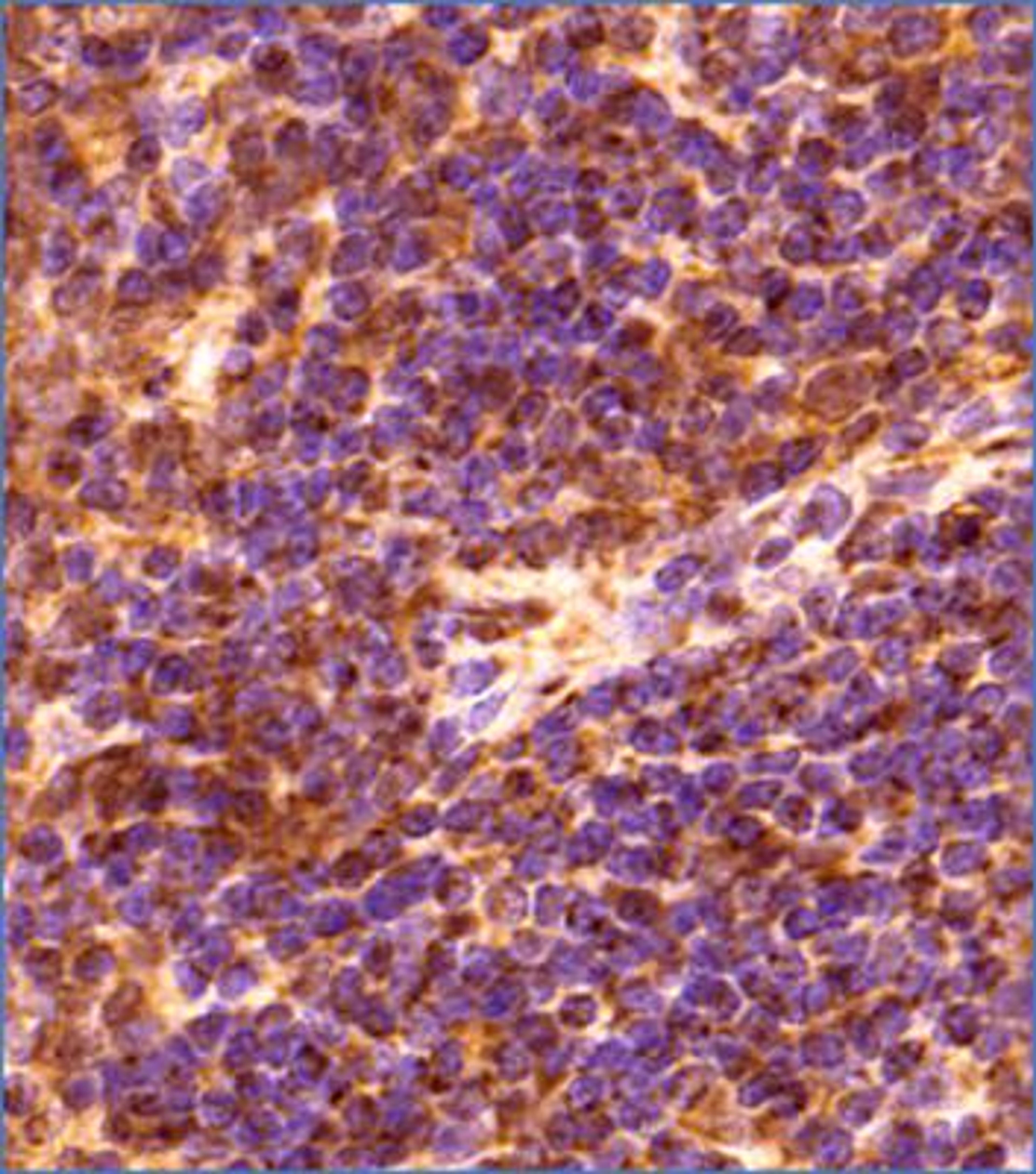 Immunohistochemistry-Paraffin: GLIPR2 Antibody [NBP2-47126] - IHC analysis of a formalin fixed and paraffin embedded tissue section of mouse spleen using GLIPR2 antibody at 1:200 dilution with HRP-DAB detection and hematoxylin counterstaining. GLIPR2 is a protein which localizes to Golgi membrane as well as extracellular exosomes, and this GLIPR2 antibody generated a very specific cytoplasmic staining with strong signal in extracellular spaces/around cellular membranes.