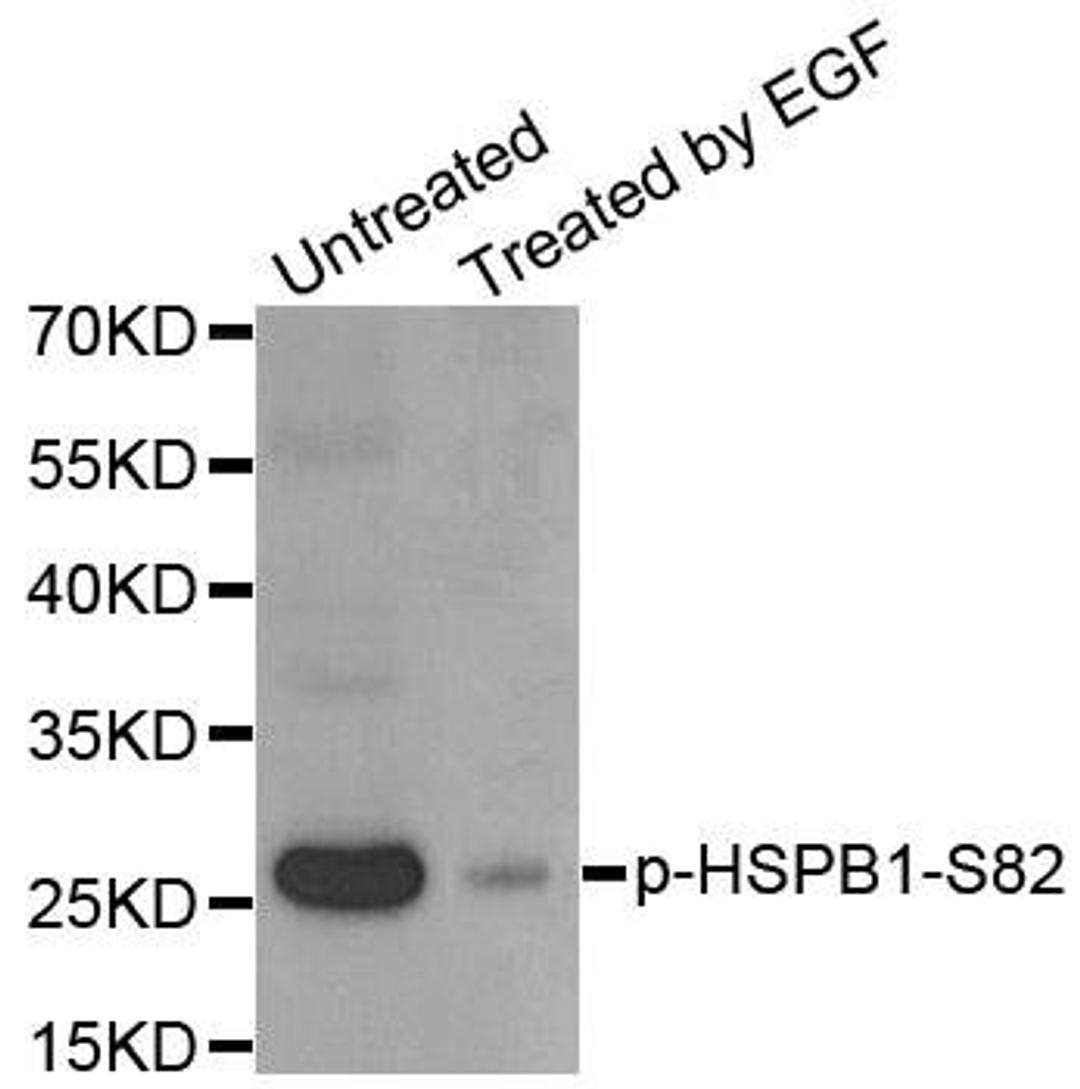 Western blot analysis of extracts of HeLa cells using HSPB1 (phospho-Ser82) antibody