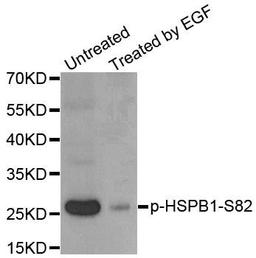 Western blot analysis of extracts of HeLa cells using HSPB1 (phospho-Ser82) antibody