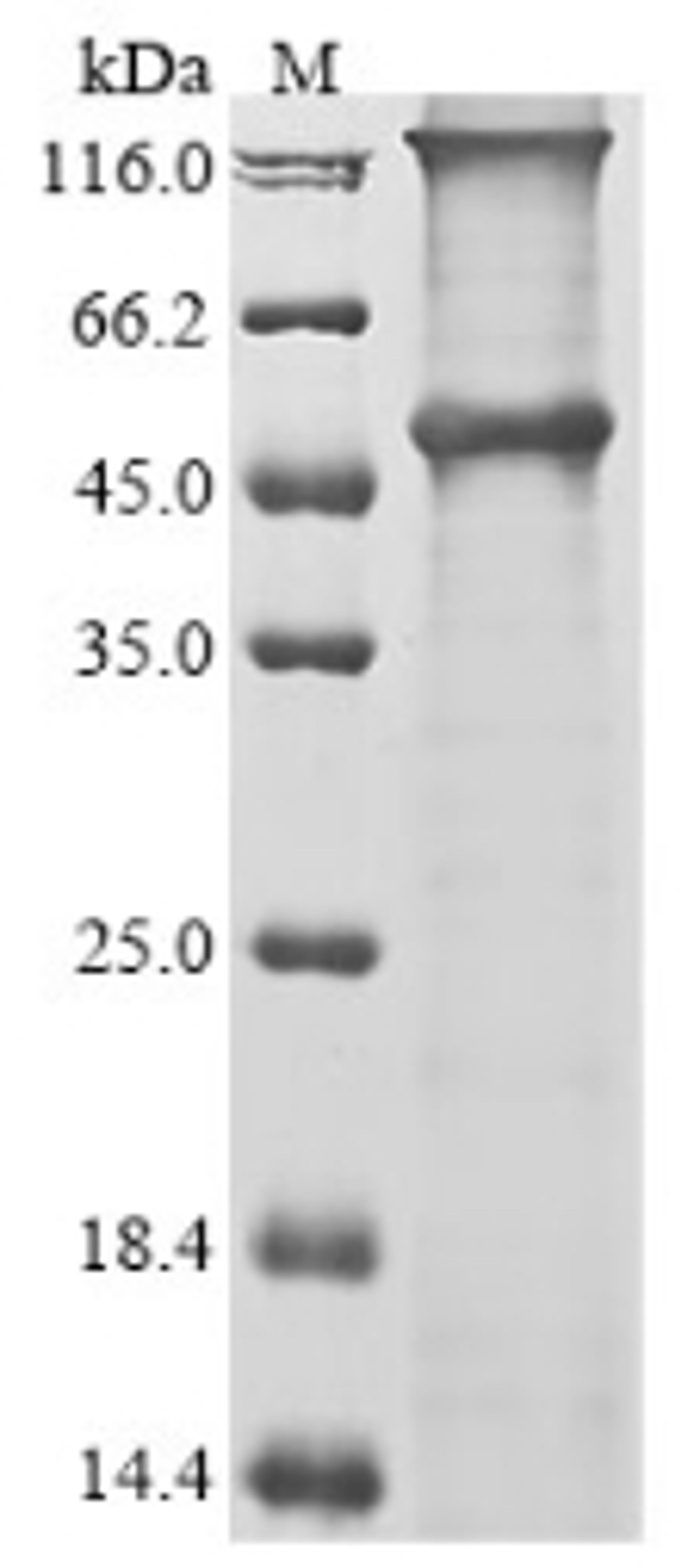 (Tris-Glycine gel) Discontinuous SDS-PAGE (reduced) with 5% enrichment gel and 15% separation gel.