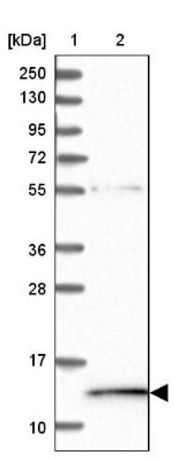 Western Blot: HPSC152 Antibody [NBP1-92009] - Lane 1: Marker [kDa] 250, 130, 95, 72, 55, 36, 28, 17, 10<br/>Lane 2: Human cell line RT-4