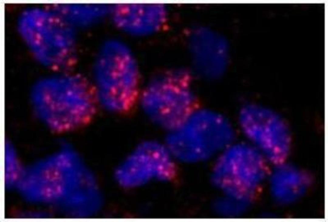 Immunocytochemistry/Immunofluorescence: MBD2 Antibody [NB100-81656] - Human breast carcinoma Affinity purified rabbit anti-MBD2 used at a dilution of 1:100.  Detection: Red-fluorescent goat anti-rabbit IgG highly crossadsorbed Antibody used at a dilution of 1:100.