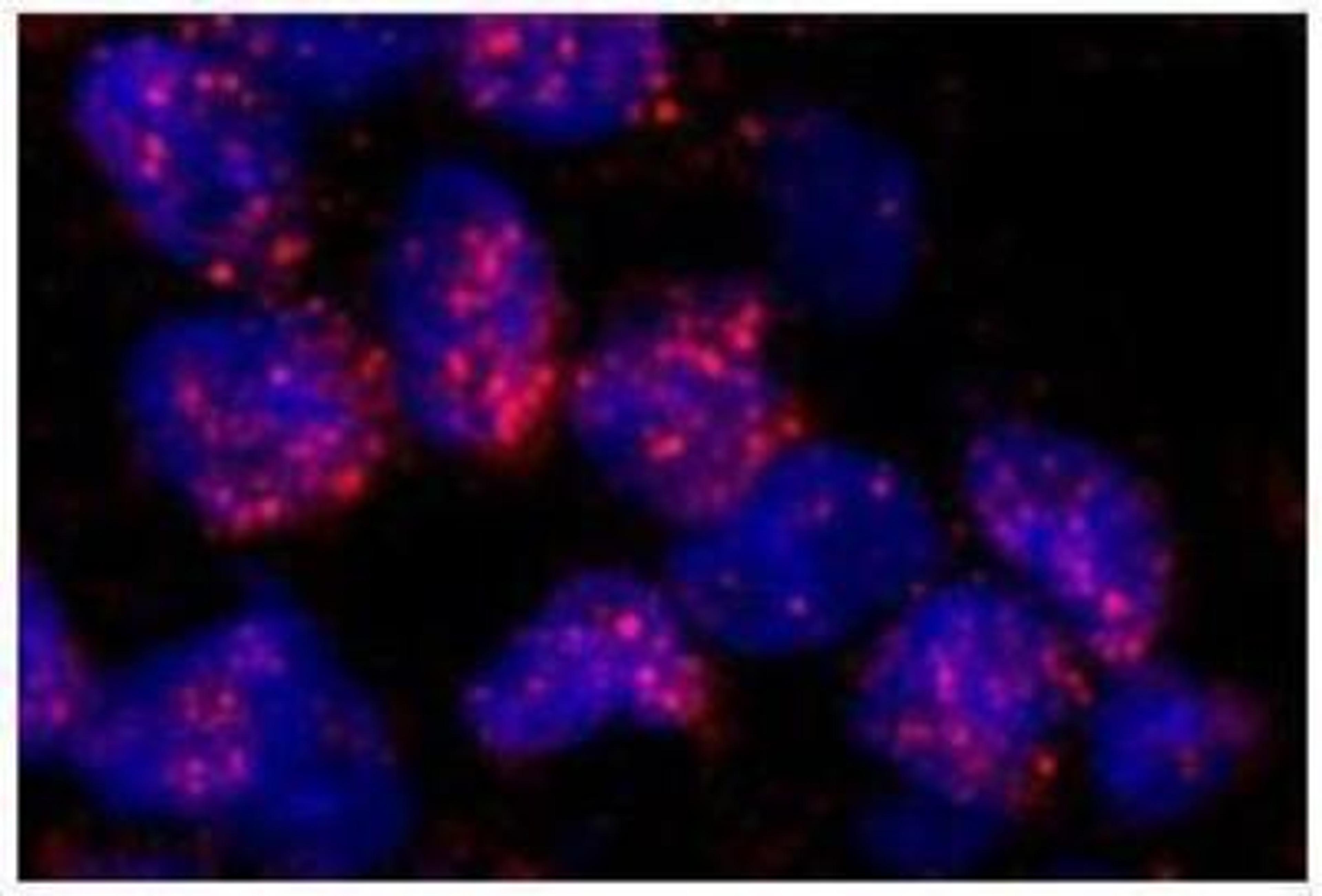 Immunocytochemistry/Immunofluorescence: MBD2 Antibody [NB100-81656] - Human breast carcinoma Affinity purified rabbit anti-MBD2 used at a dilution of 1:100.  Detection: Red-fluorescent goat anti-rabbit IgG highly crossadsorbed Antibody used at a dilution of 1:100.