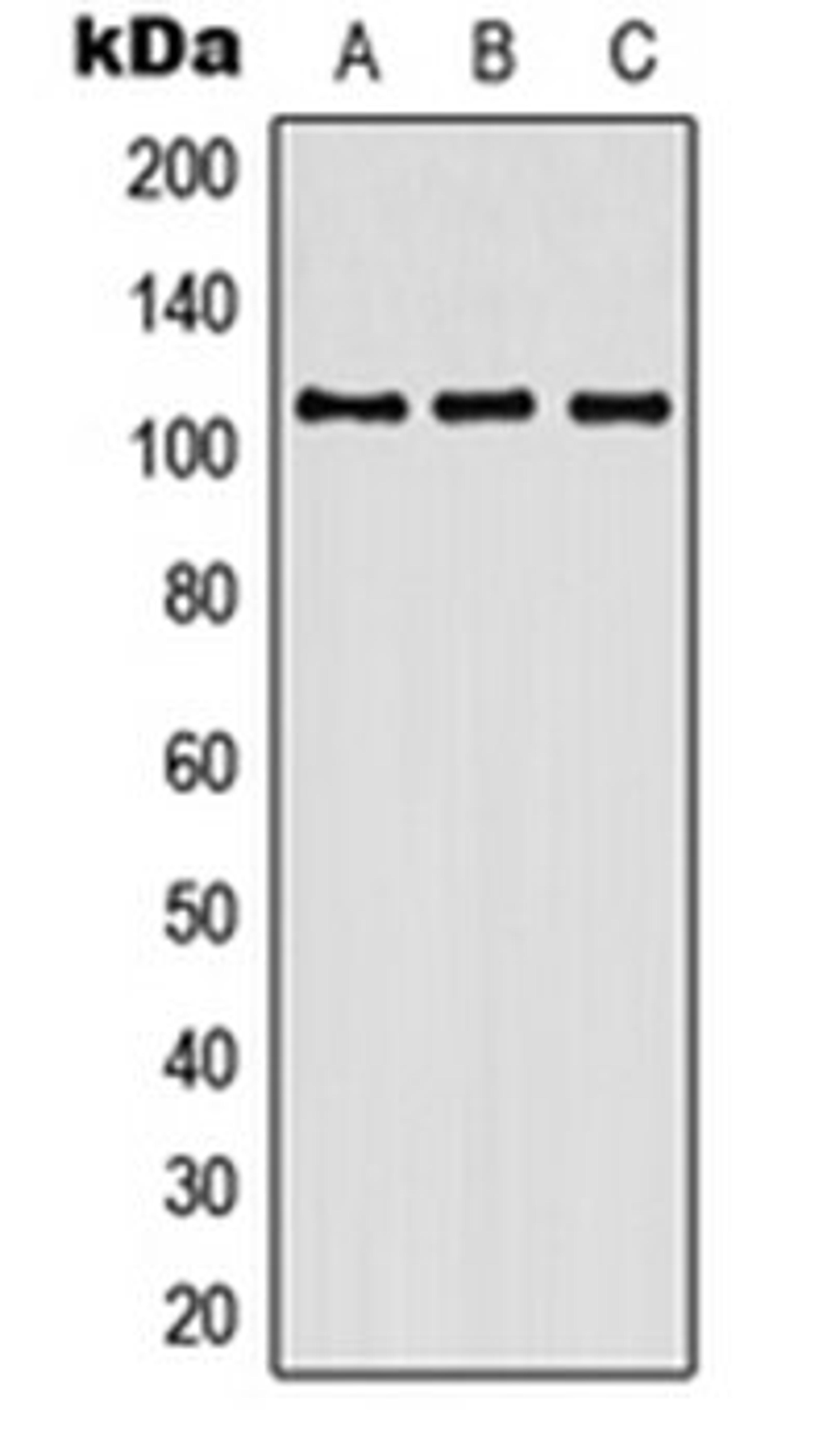 Western blot analysis of HEK293T (Lane 1), SP2/0 (Lane 2), H9C2 (Lane 3) whole cell lysates using CNTN3 antibody