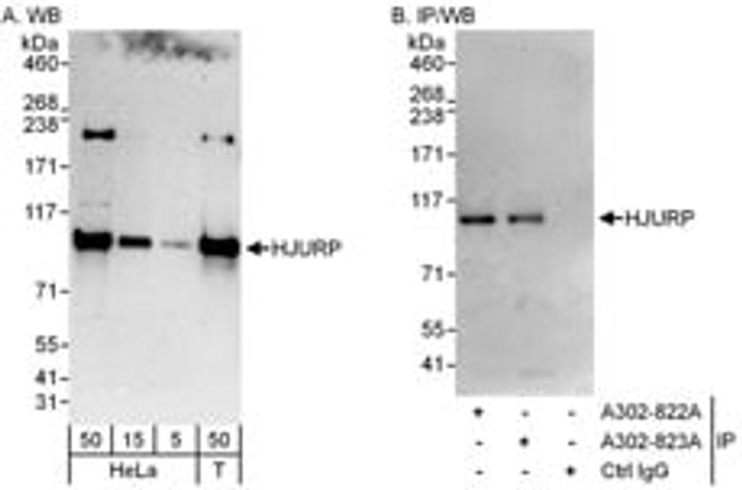 Detection of human HJURP by western blot and immunoprecipitation.