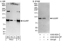 Detection of human HJURP by western blot and immunoprecipitation.