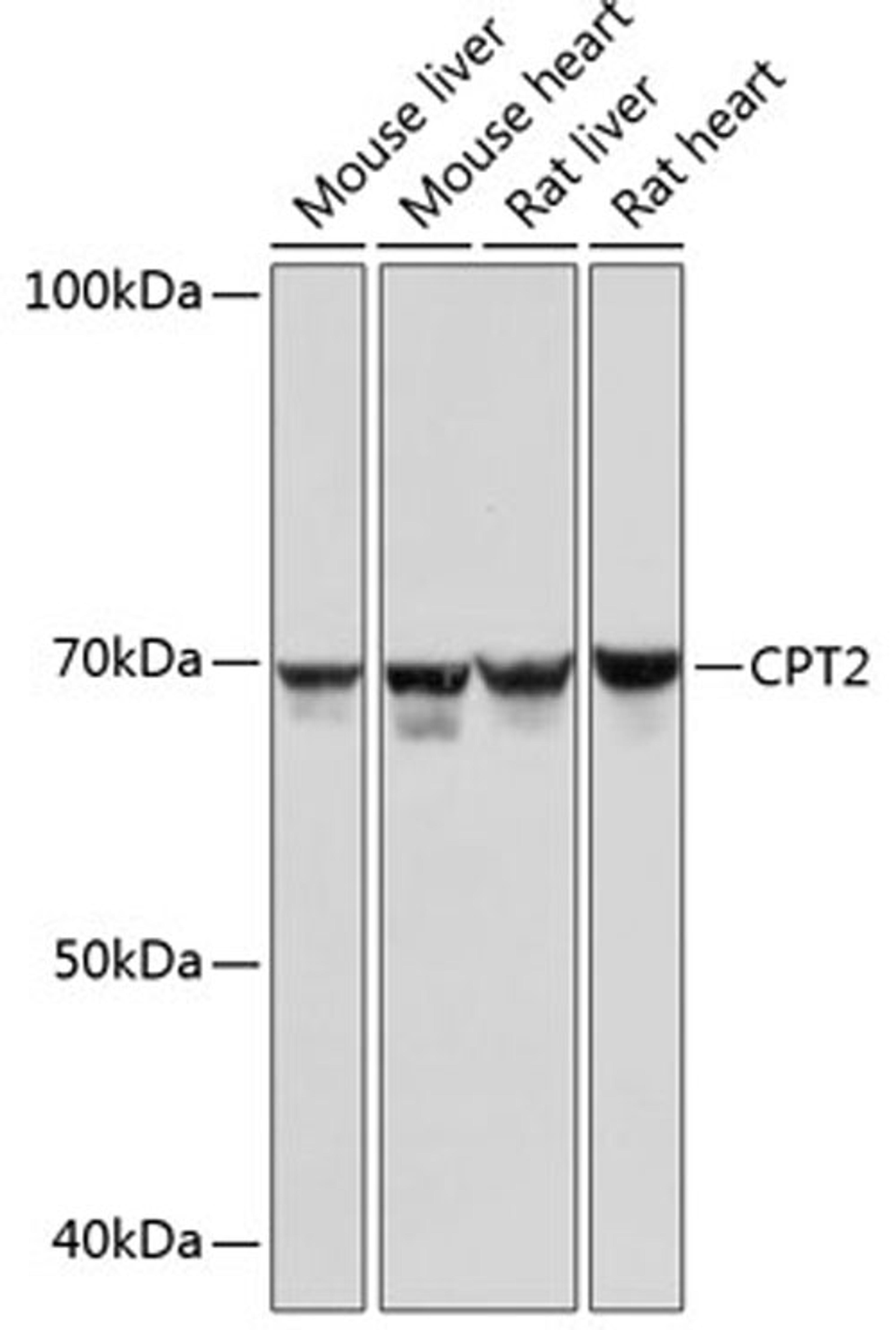 Western blot - CPT2 Rabbit mAb (A0653)