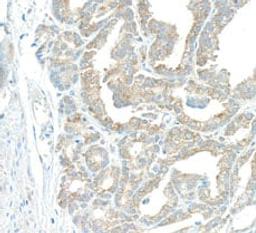 Detection of human EBP1 by immunohistochemistry.