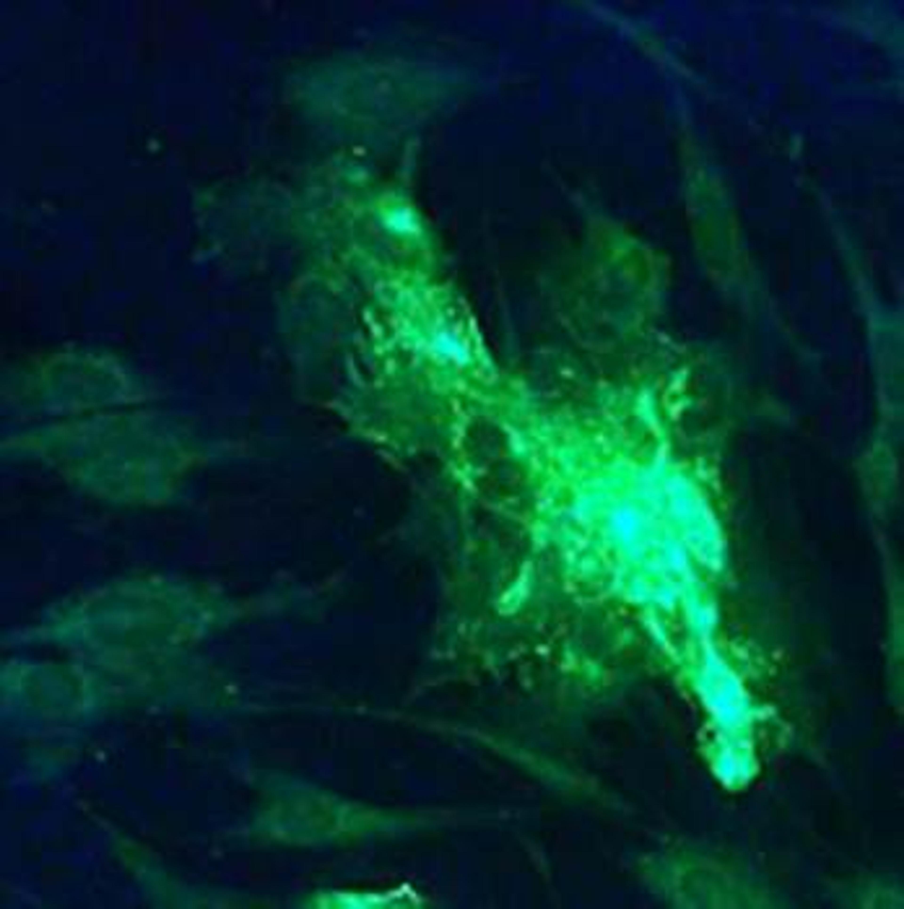 Immunofluorescence analysis of Human Lung Fibroblast Cells using VZV (gpI & IV) antibody at 1:20 dilution