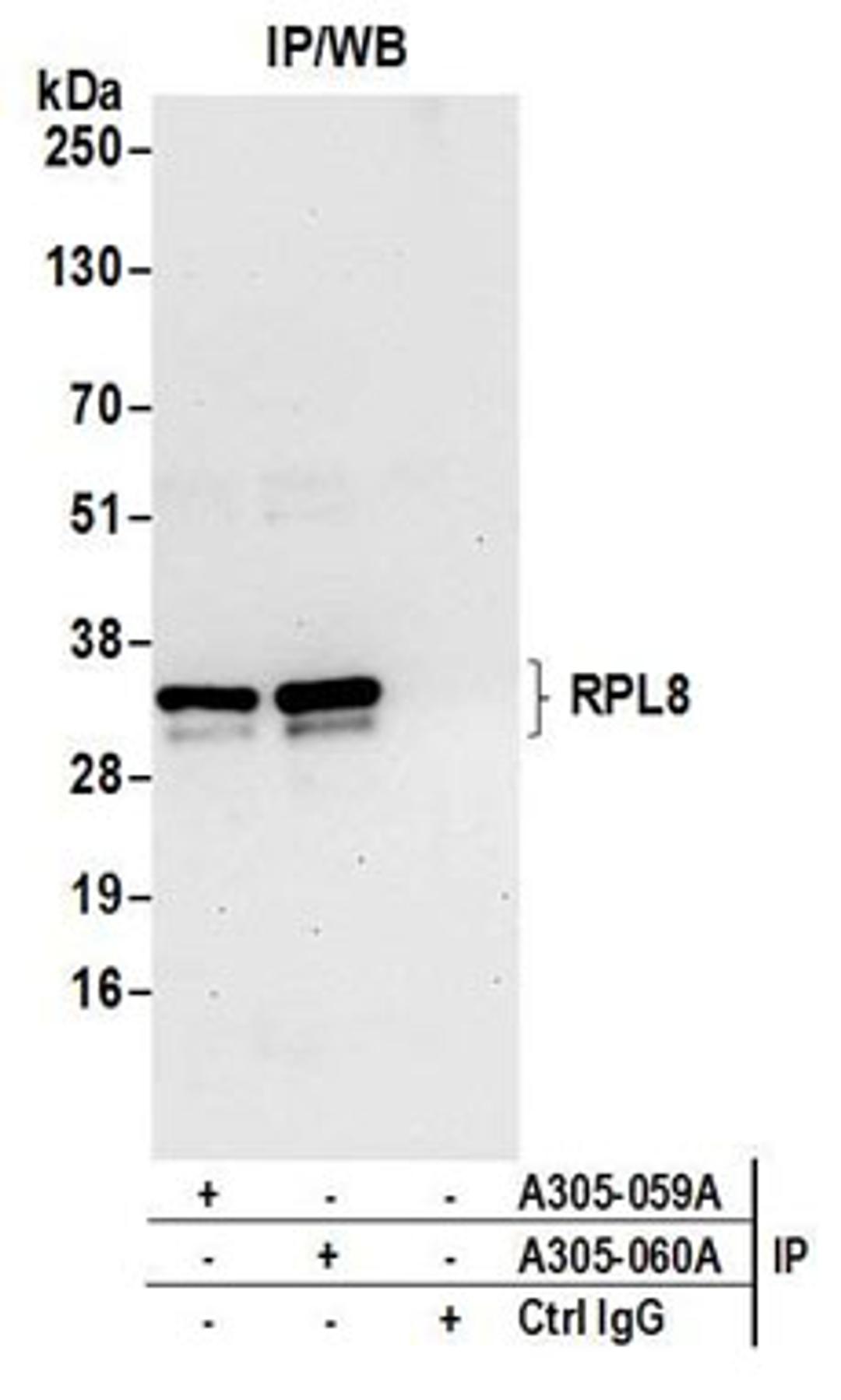 Detection of human RPL8 by western blot of immunoprecipitates.