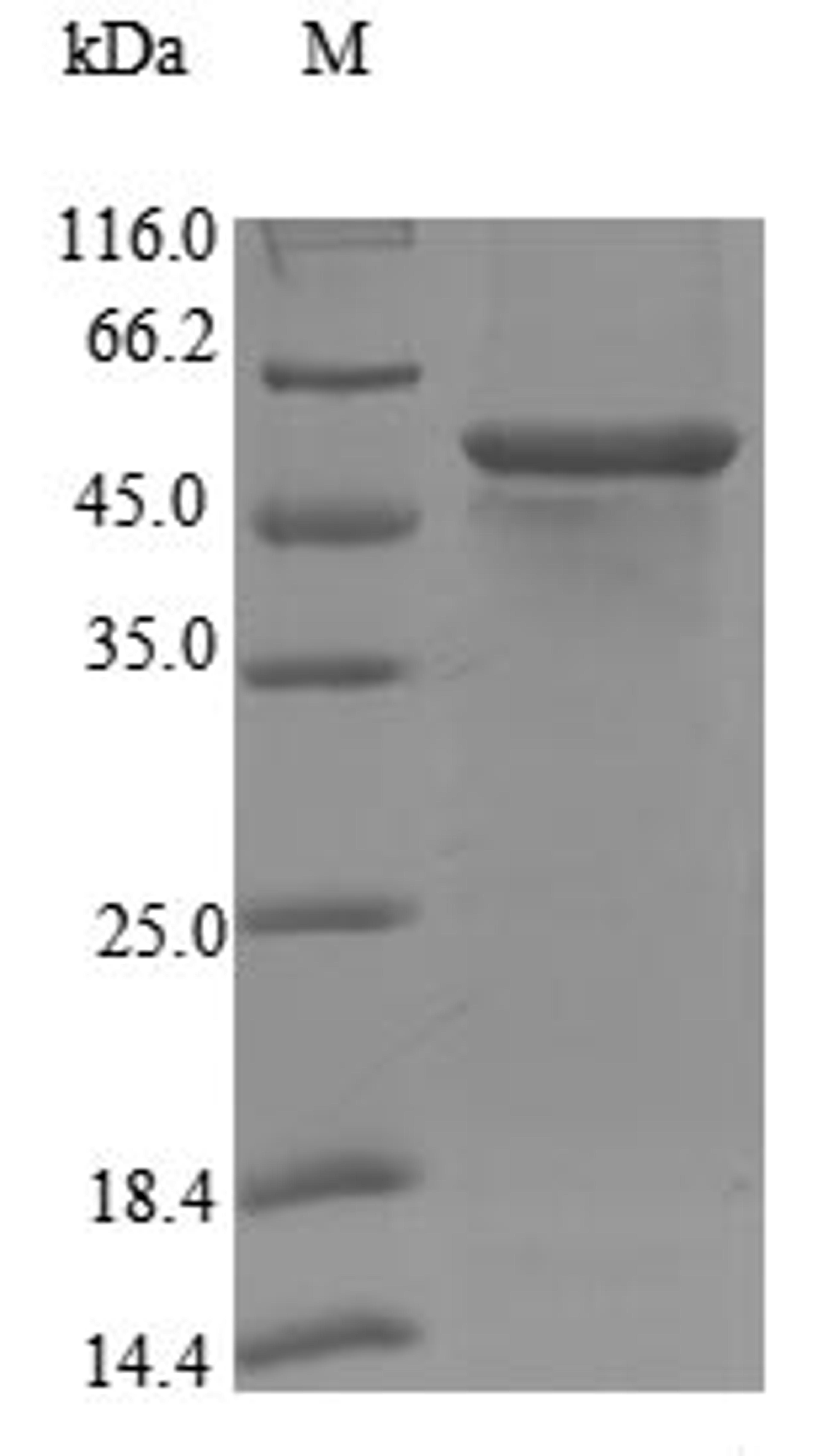 (Tris-Glycine gel) Discontinuous SDS-PAGE (reduced) with 5% enrichment gel and 15% separation gel.