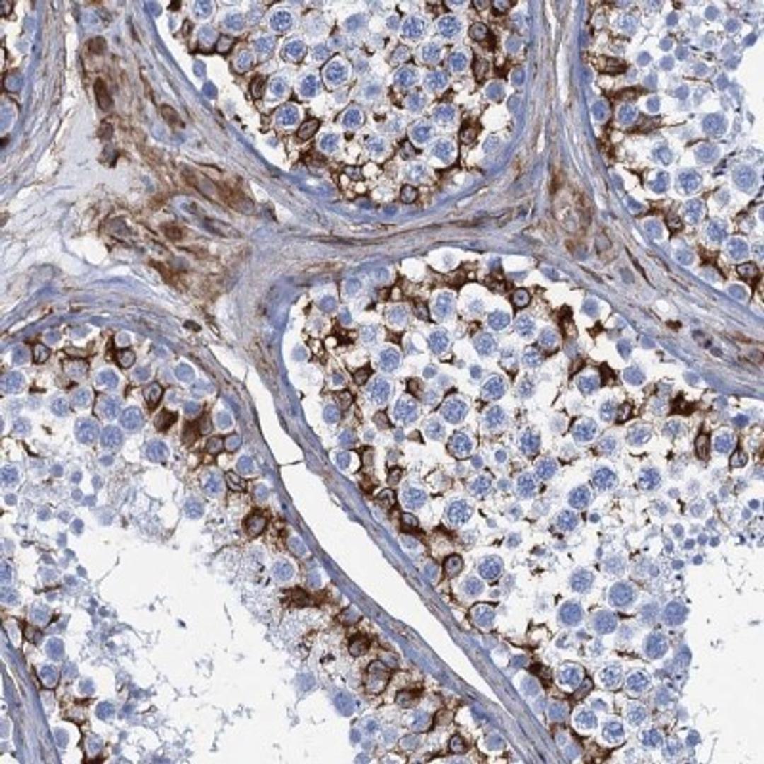 Immunohistochemistry: PGM2 Antibody [NBP2-32601] - Immunohistochemical staining of human testis shows strong cytoplasmic staining in a subset of cells in seminiferous ducts.