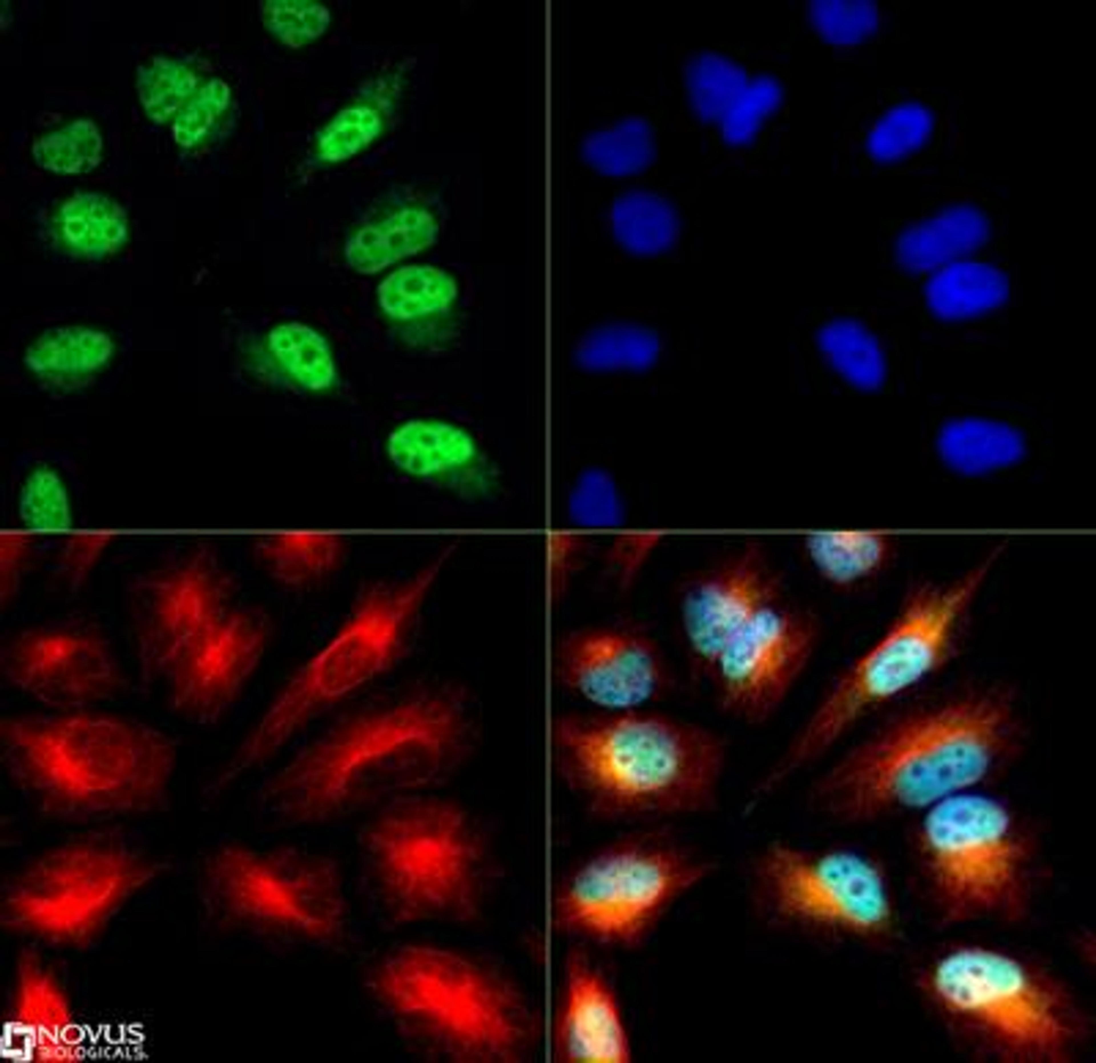 Immunocytochemistry/Immunofluorescence: Histone H3 [ac Lys9, p Ser10] Antibody [NB21-1075] - Histone H3 [ac Lys9, p Ser10] antibody was tested in HeLa cells at 1:10 dilution with Dylight 488 (green). Nuclei and alpha-tubulin were counterstained with DAPI (blue) and Dylight 550 (red). Image objective 40x.