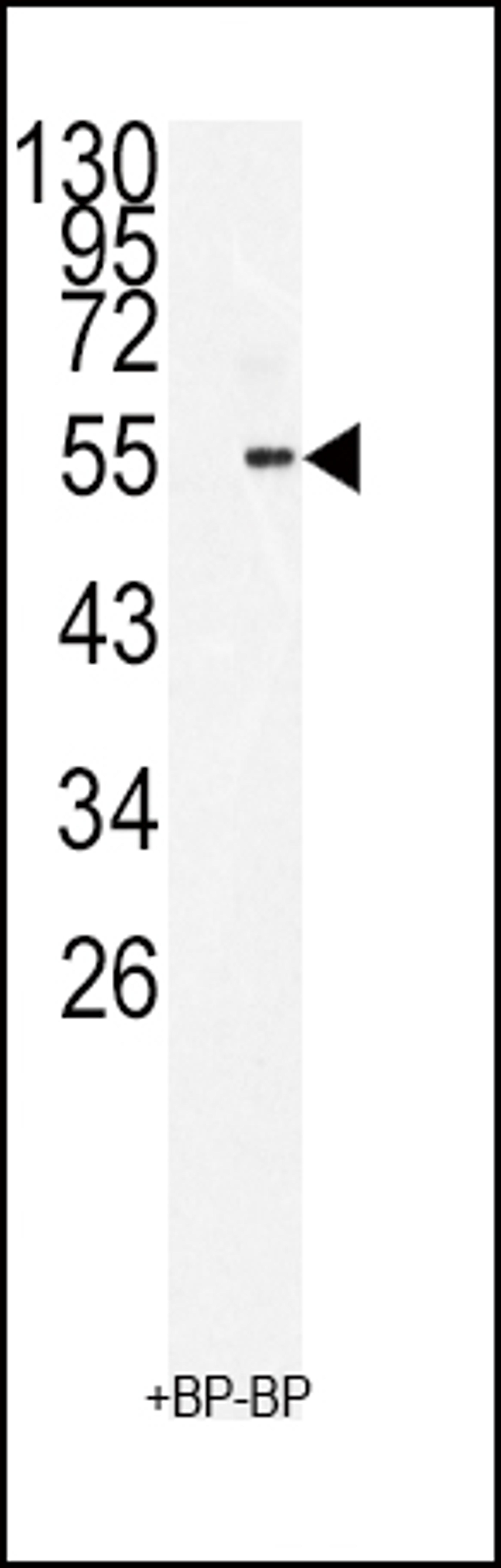 Western blot analysis of BMI1 Antibody antibodyin 293 cell line lysates (35ug/lane)