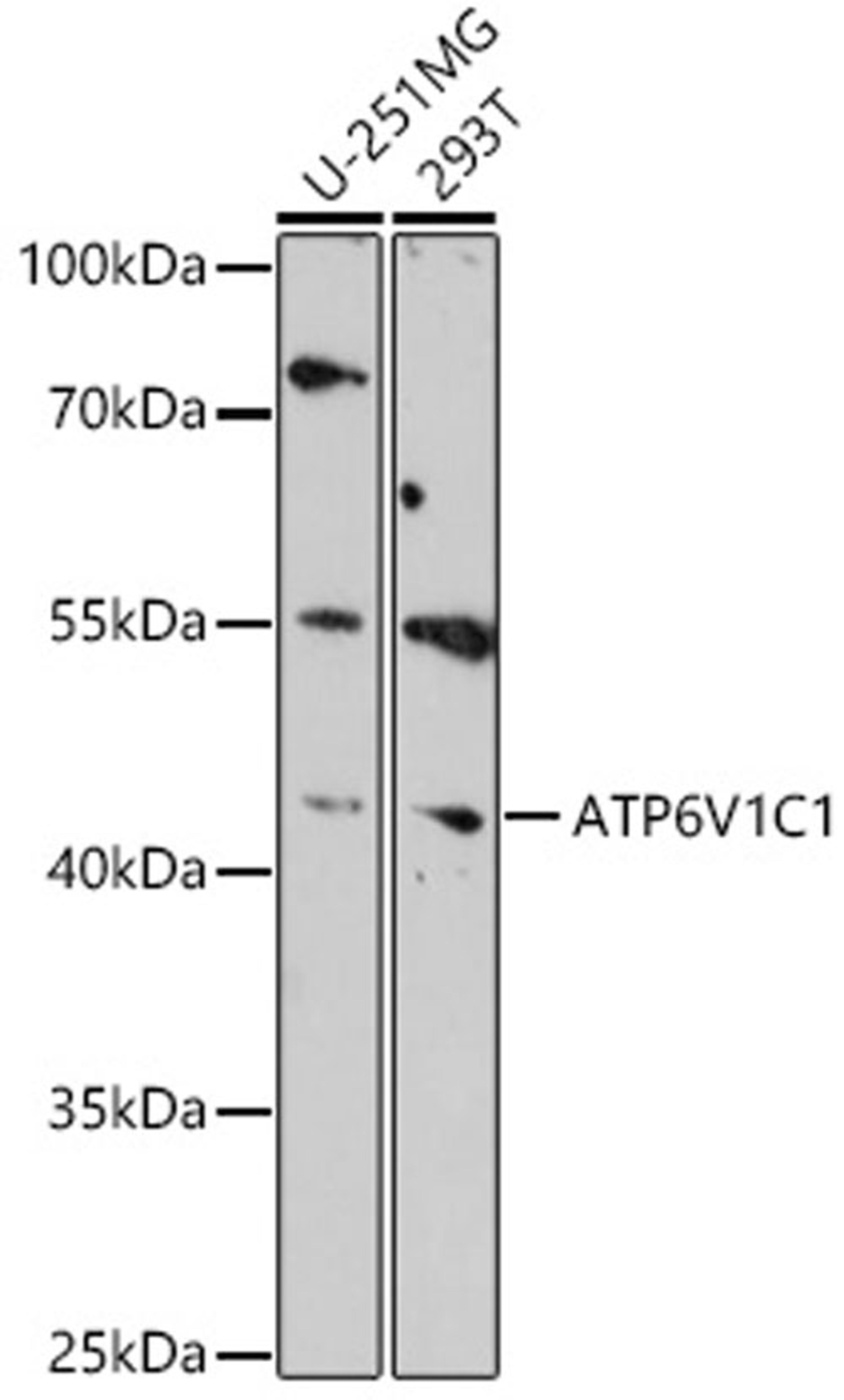 Western blot - ATP6V1C1 antibody (A18253)