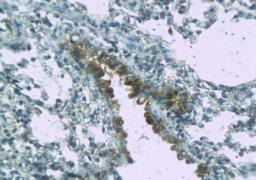 IHC-P of lung tissue in mice (MyD88 antibody at 1:200)