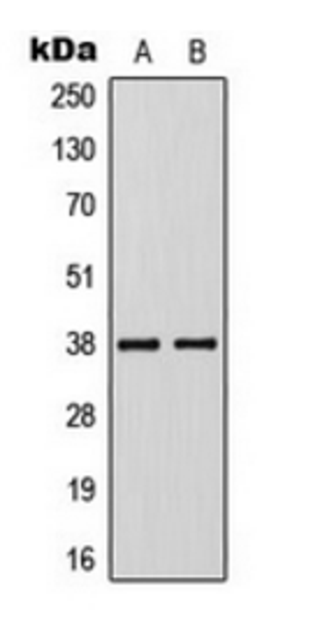 Western blot analysis of Jurkat (Lane 1), VEC (Lane 2) whole cell lysates using KLF1/5/7 antibody