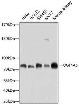 Western blot - UGT1A6 antibody (A10033)